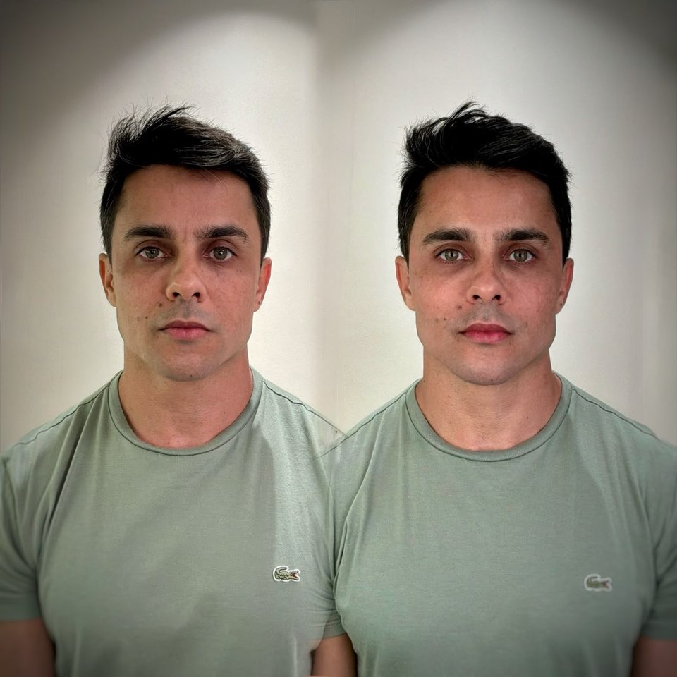 Comparativo autorizado de resultado estético facial, imagem 9 de 13