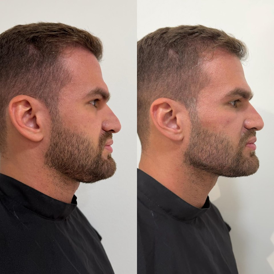 Comparativo autorizado de resultado estético facial, imagem 11 de 13